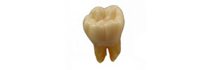 歯牙の模型